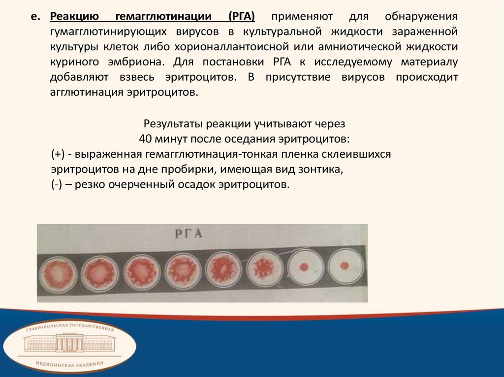 Явление гемагглютинации, его использование в вирусологии.. Опсонофагоцитарная реакция микробиология схема. Реакция нейтрализации. Реакция нейтрализации микробиология.