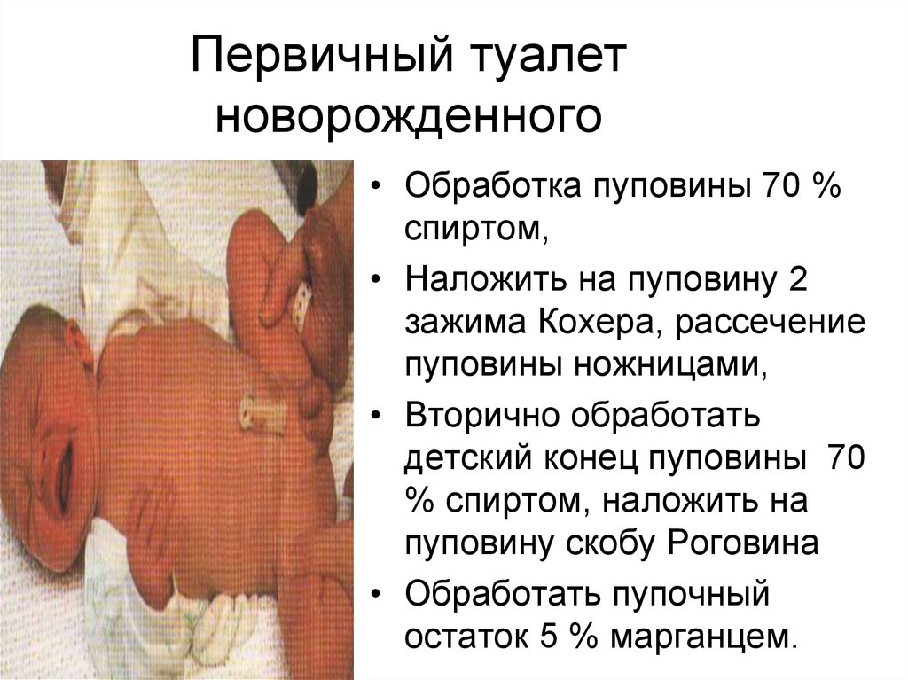 Первый туалет новорожденного. Обработка пуповины новорожденного алгоритм. Первичный туалет новорожденного (2 этапа обработки пуповины).. Обработка пуповины, туалет новорожденного. Первичная и вторичная обработка новорожденного.