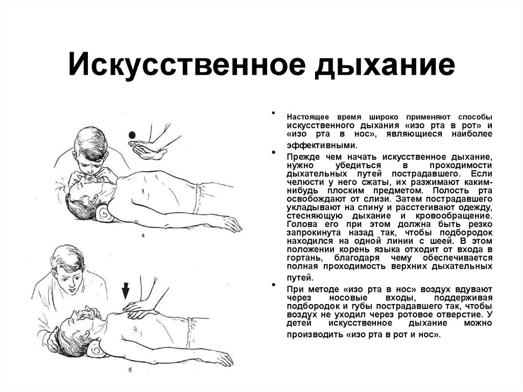 Искусственное дыхание признаки. Искусственное дыхание способы схема. Искусственная вентиляция легких и непрямой массаж сердца кратко. Непрямой массаж сердца ИВЛ техника проведения кратко. Схема выполнения искусственного дыхания.