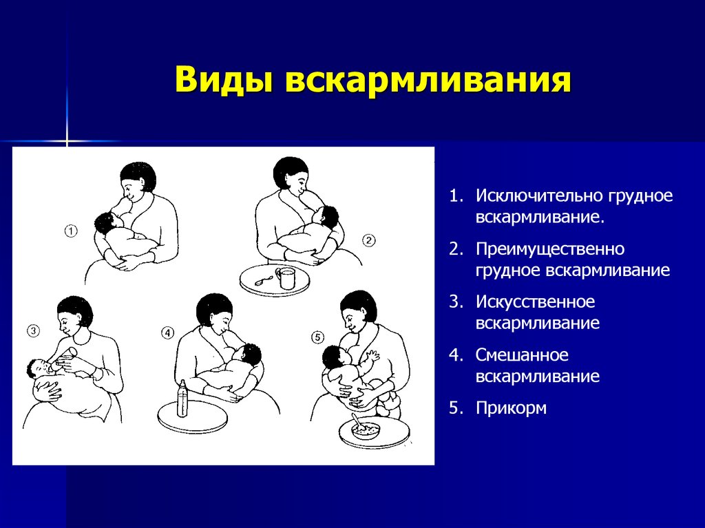 Способы вскармливания. Виды вскармливания. Виды естественного вскармливания. Разновидности грудного вскармливания. Виды вскармливании новорожденного.