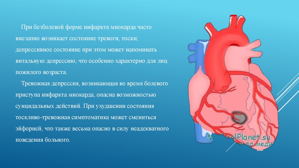 Инфаркт миокарда верхушки сердца. Инфаркт верхушки сердца. Безболезненный инфаркт миокарда. Форма инфаркта миокарда у лиц старческого возраста.