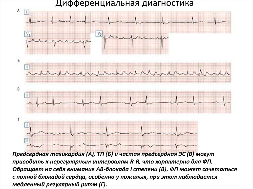 Дифференциальная диагностика