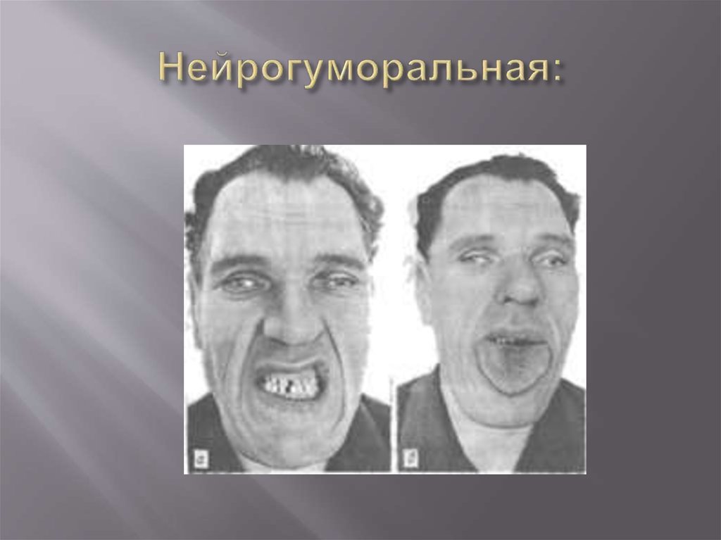 Нейрогуморальная: