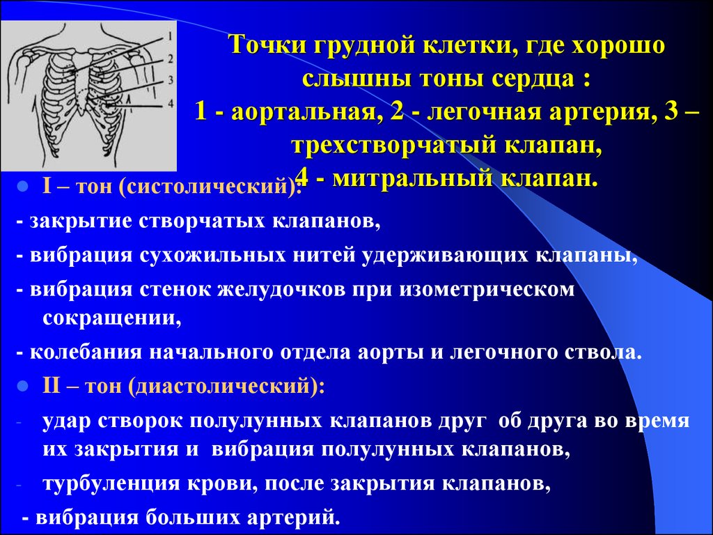 Где слышен. Точки на грудной клетке. Сухожильных нитей трикуспидального клапана,. Тоны сердца в первой точке. II тон сердца для клапана легочного ствола.