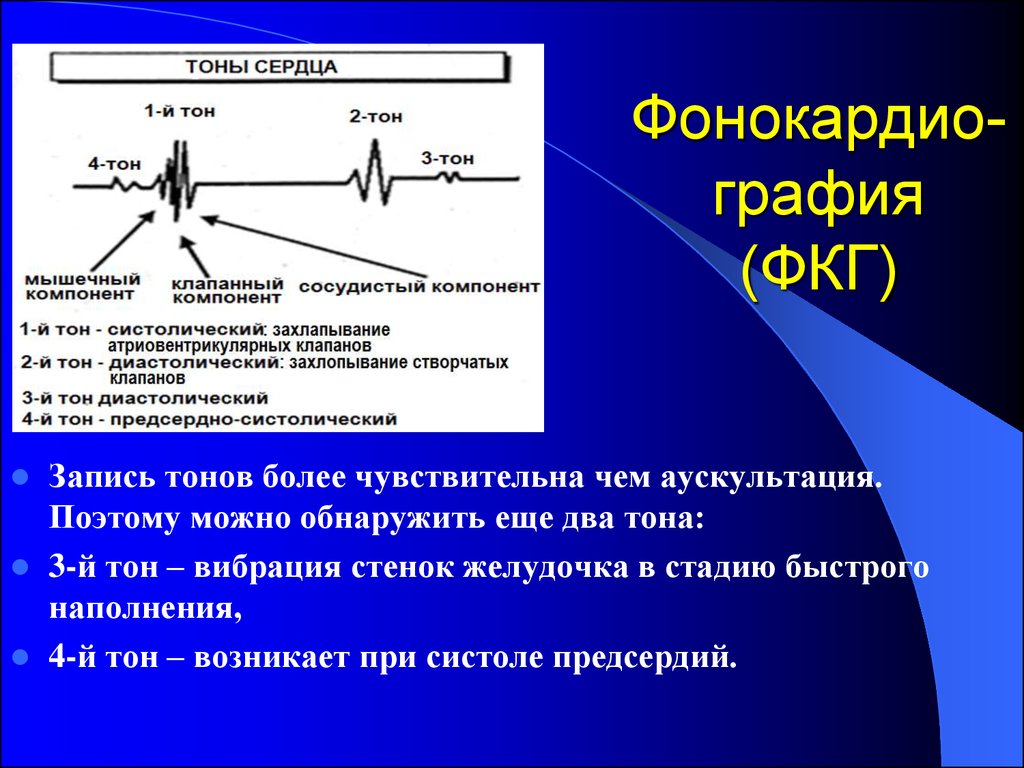 Звук тонов сердца. Фонокардиография (ФКГ). Схема ФКГ первого тона. Тоны сердца фонокардиография. Тоны сердца на ФКГ.