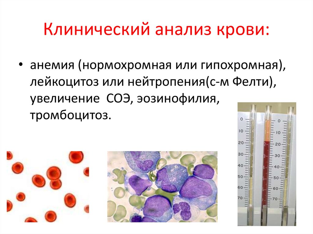 Клинический анализ крови: