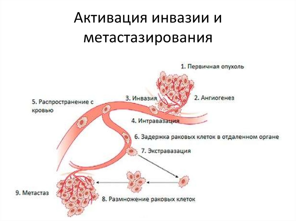 Инвазивные железы. Гематогенное распространение метастазов схема. Этапы метастазирования опухоли. Гематогенный путь метастазирования опухоли. Метастазирование опухолей схема.