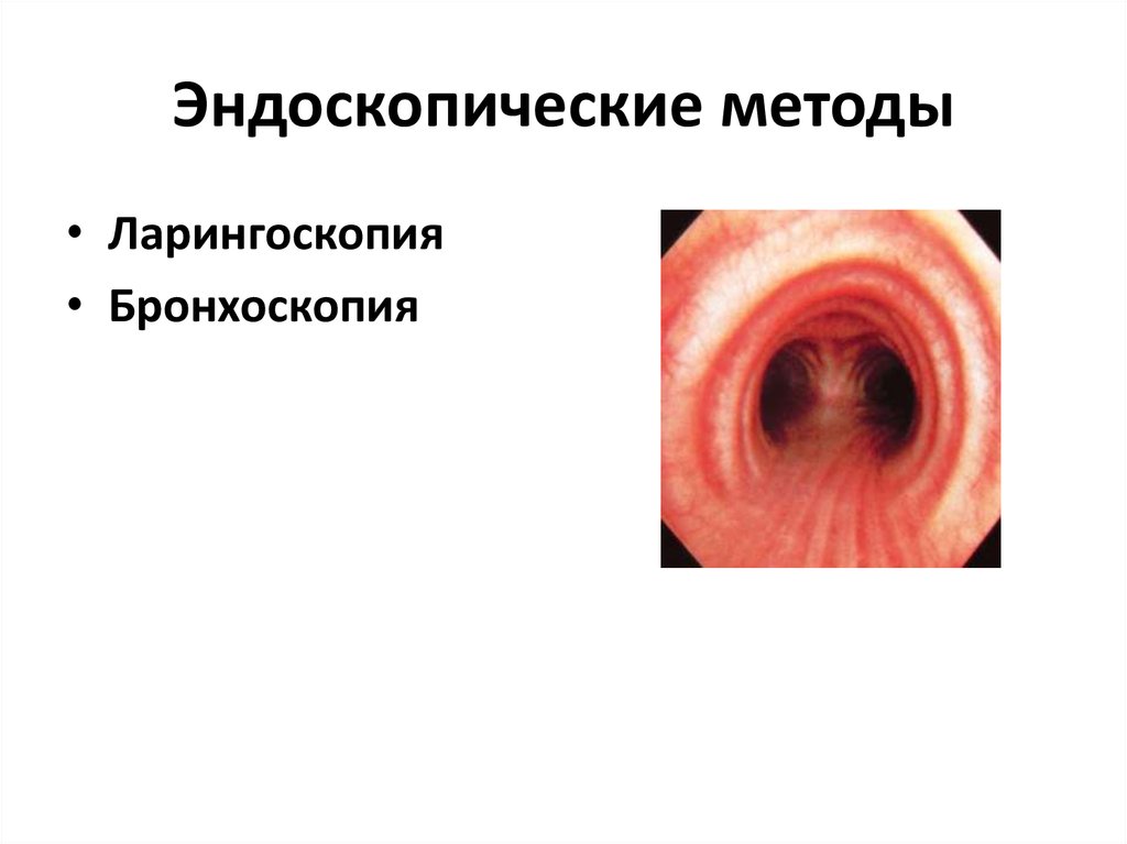 Эндоскопические методы