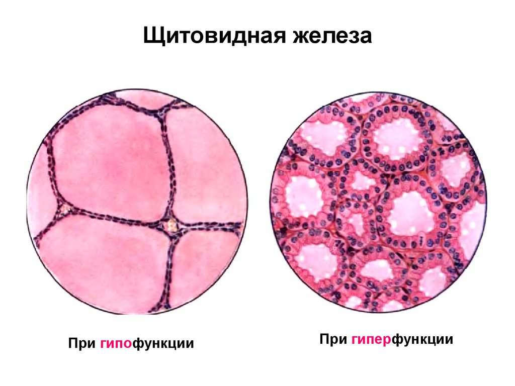 Щитовидная железа гистология рисунок