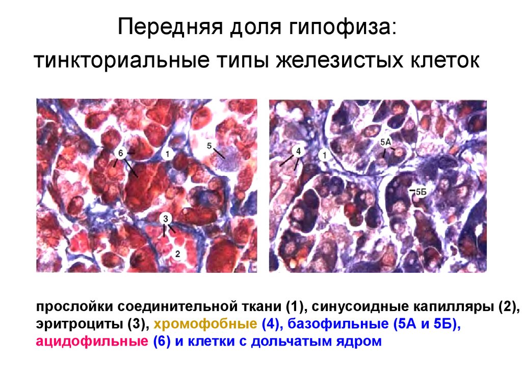 Гипофиз ткань. Базофильные клетки передней доли гипофиза и их гормоны. Хромофобные эндокриноциты гипофиза. Клетки гипофиза гистология. Ацидофильные клетки передней доли гипофиза:.