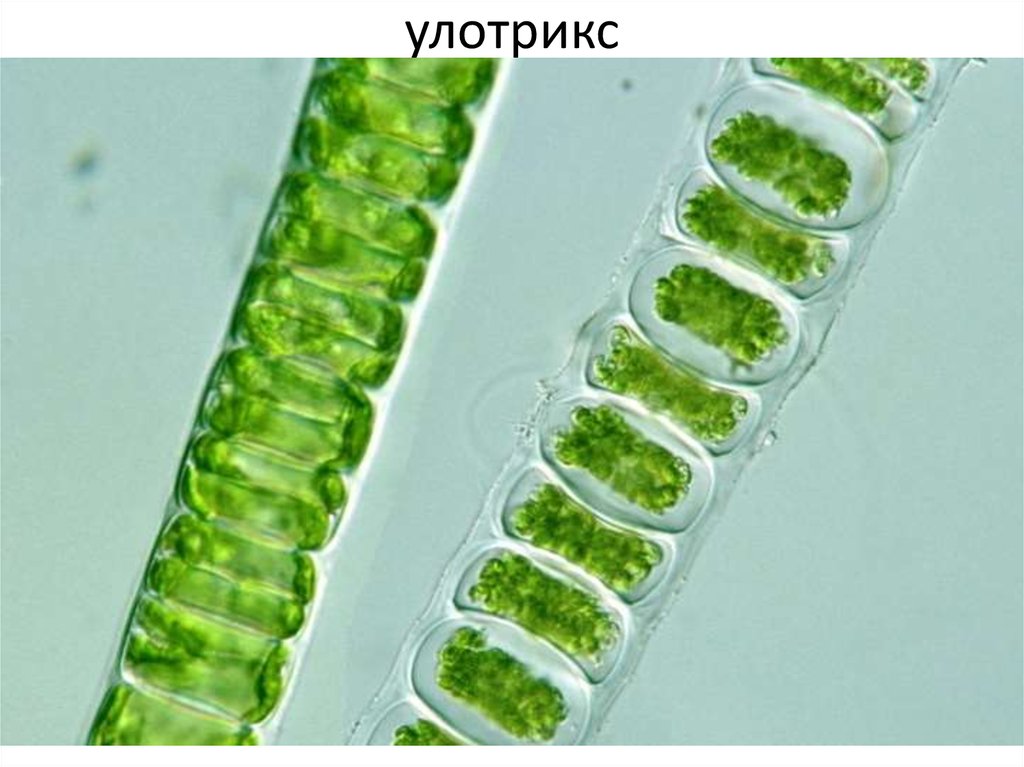 Улотрикс и спирогира. Улотрикс водоросль. Зеленые водоросли улотрикс. Улотрикс (Ulothrix). Улотрикс многоклеточная.