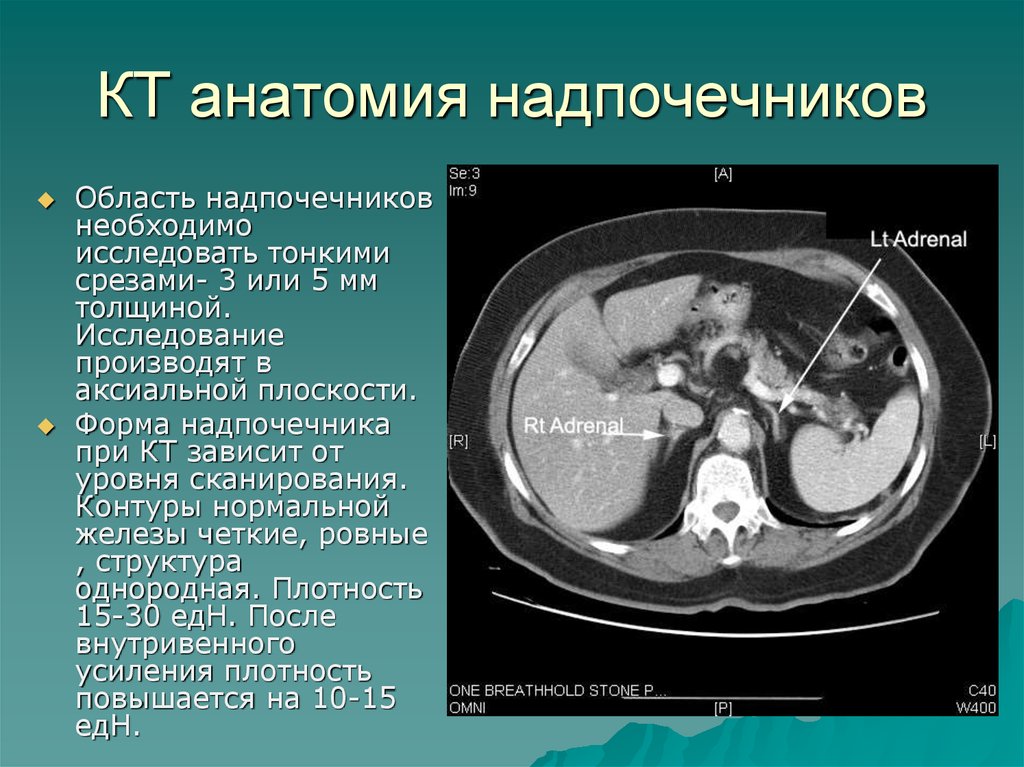 Узел надпочечника