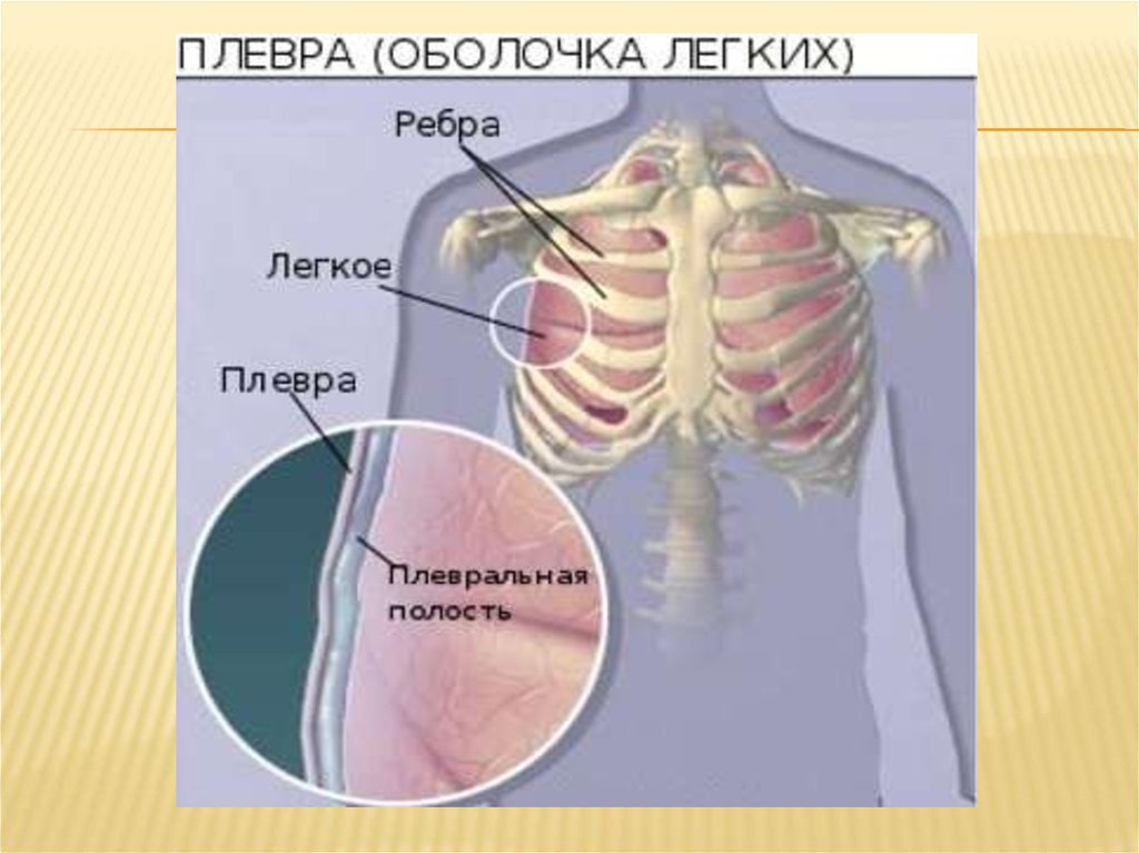 Оболочка легких 6. Оболочки легких. Осумкованный плеврит мкб 10. Осумкованный плеврит код по мкб 10.