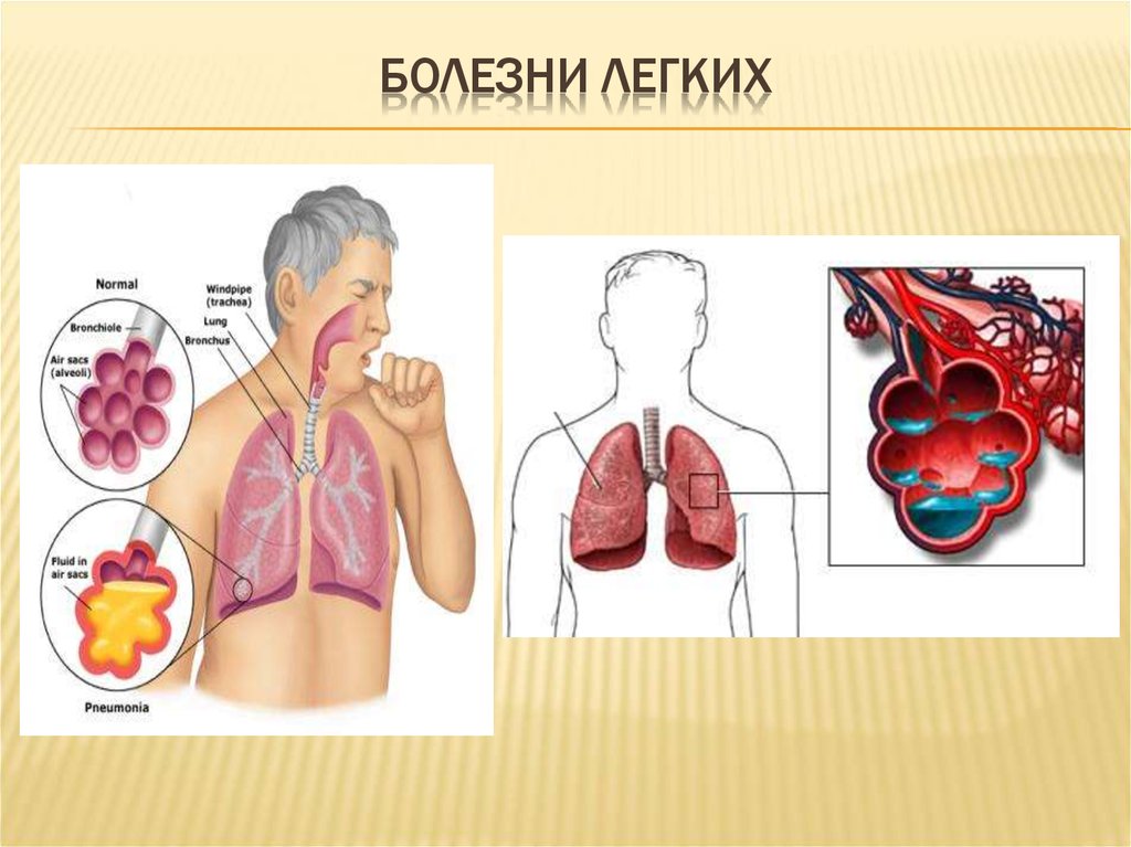 Система легких. Воздухоносные полости в легких. Органы дыхания – легкие и кожа.