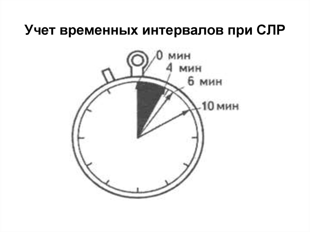 Временные промежутки. Временные промежутки при СЛР. Временные промежутки при аварии.