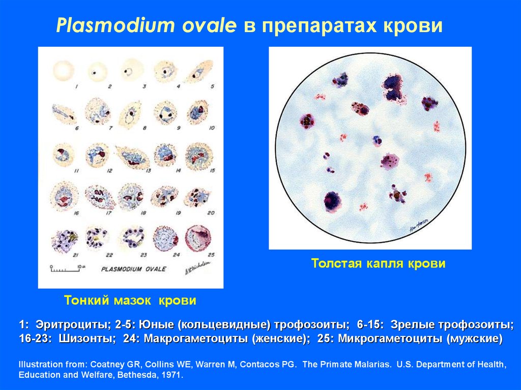 Тонкий мазок и толстая капля