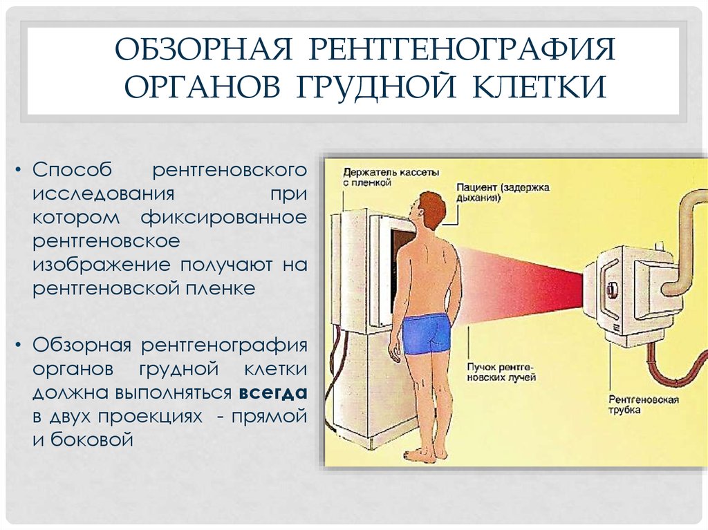 В чем смысл рентгенографии с прямым увеличением рентгеновского изображения