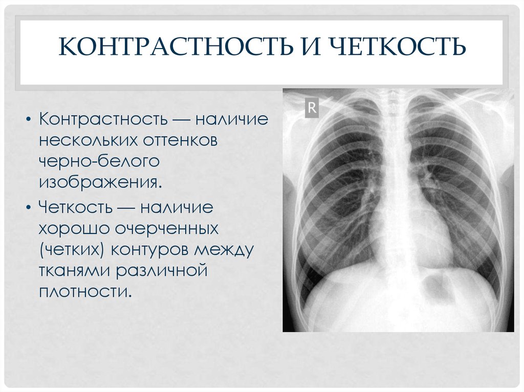 Контраст между деталями рентгеновского изображения главным образом обусловлен