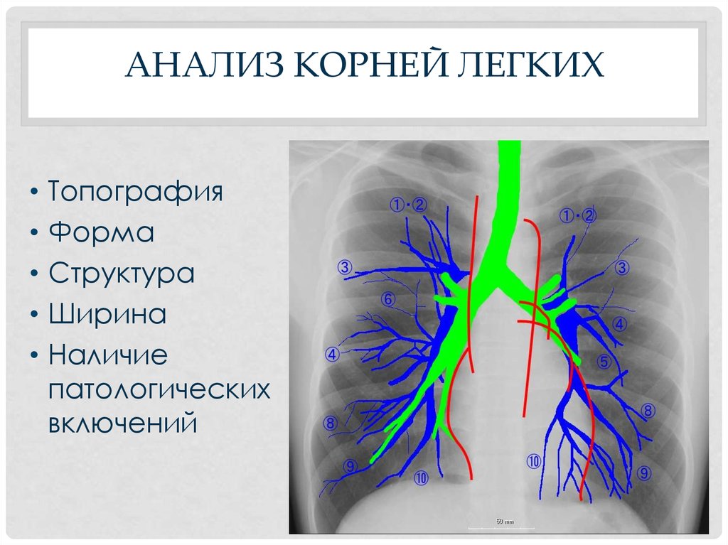 Корни легких структурны что это