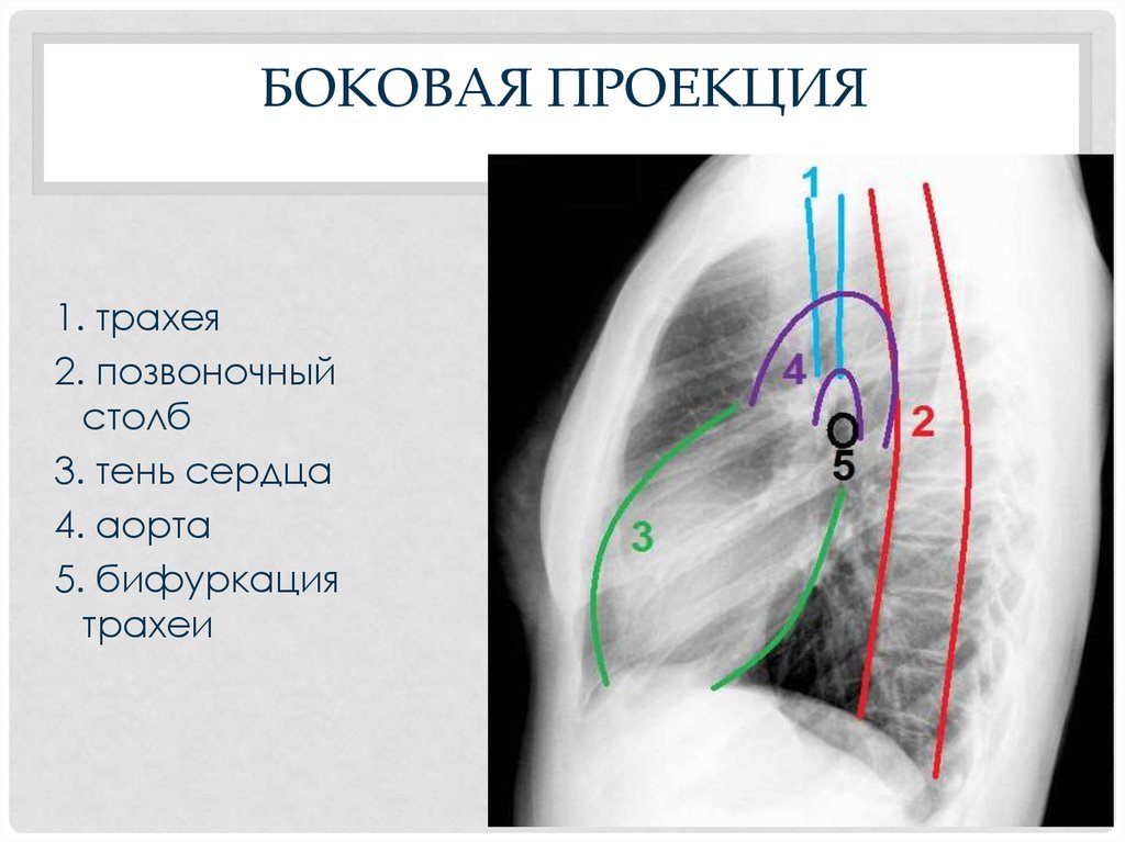 Рентгенография боковой проекции. ОГК В правой боковой проекции. Рентгеноанатомия легких в боковой проекции. Левая боковая проекция сердца рентген.