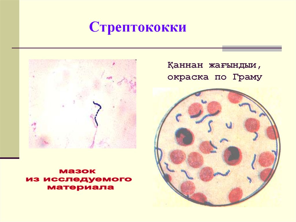 В мазке стрептококки располагаются в виде