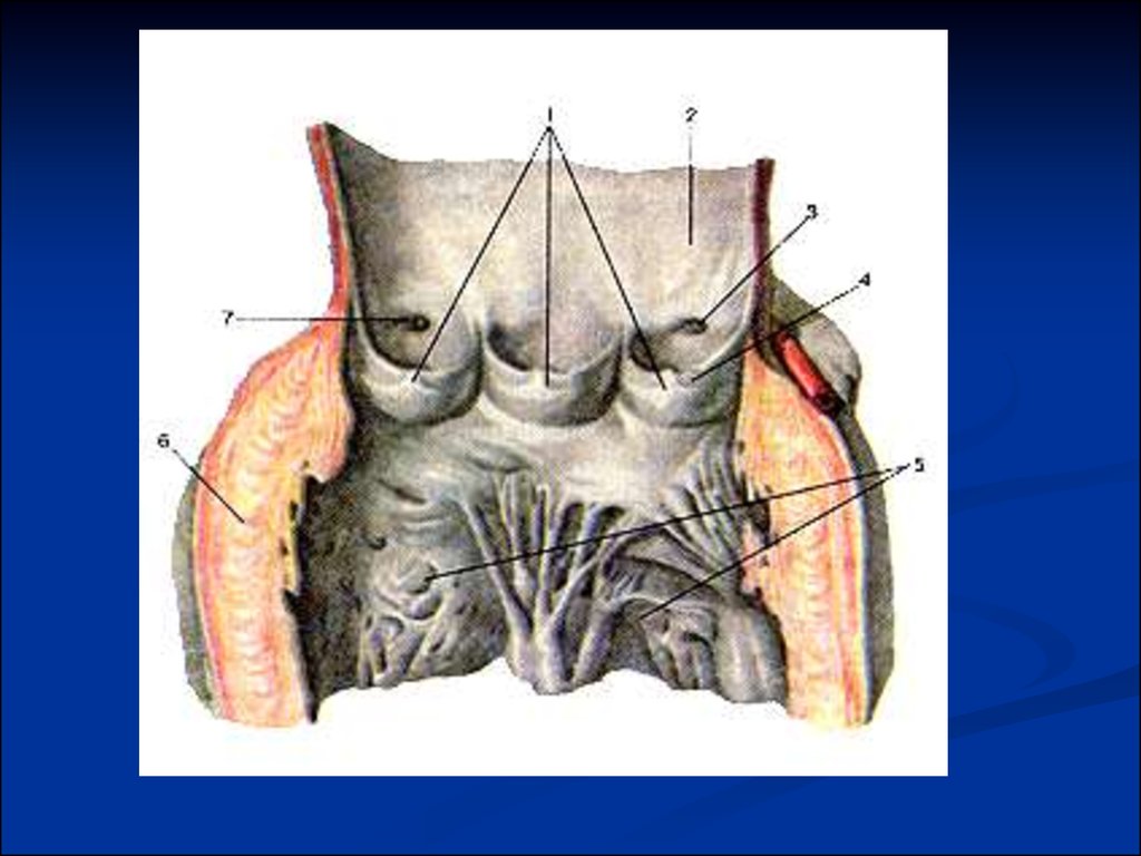 Левый отверстие. Заслонки полулунных клапанов. Кармашки полулунных клапанов. Полулунные клапаны аорты. Полулунные заслонки клапана.
