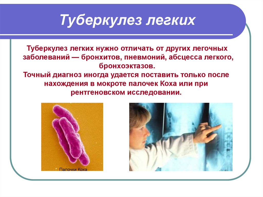 Защита от туберкулеза. Туберкулез презентация. Туберкулез палочка Коха симптомы. Диагноз туберкулез.
