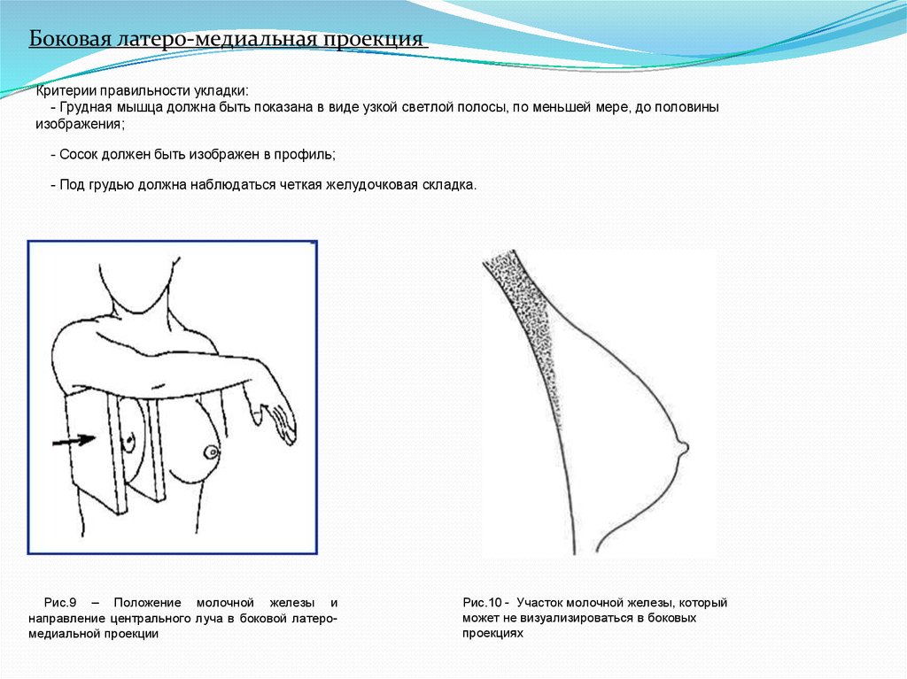 Положение груди. Положение на грудь. Критерии правильности укладки молочной железы. Исследование молочной железы в 4 проекциях. Медиальная и латеральная грудные мышцы.
