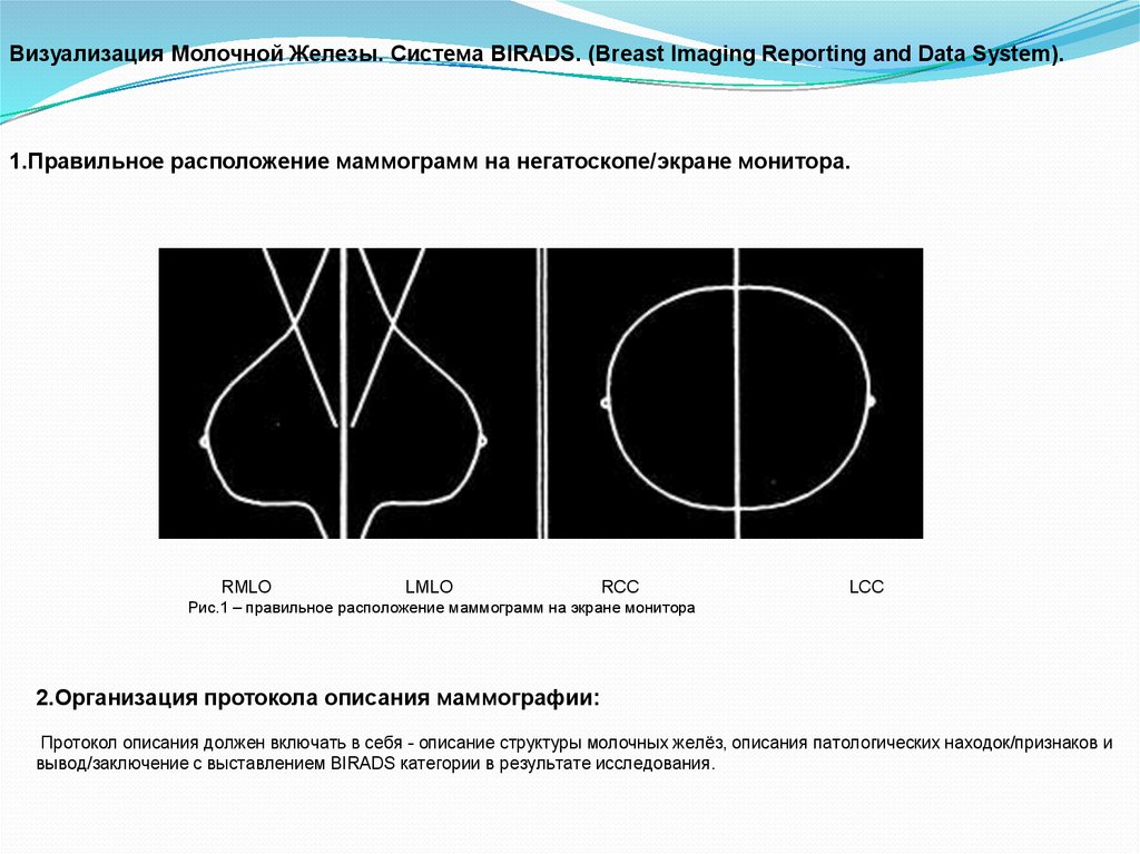 Проекции в маммографии