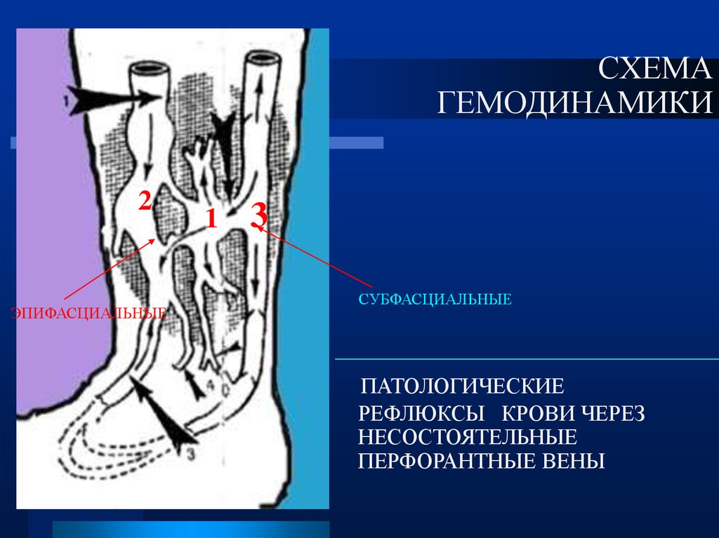 Перфорантные вены нижних конечностей это