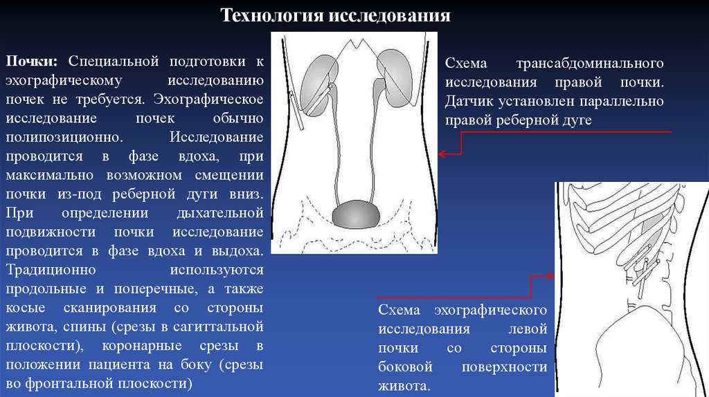 Исследование почек подготовка