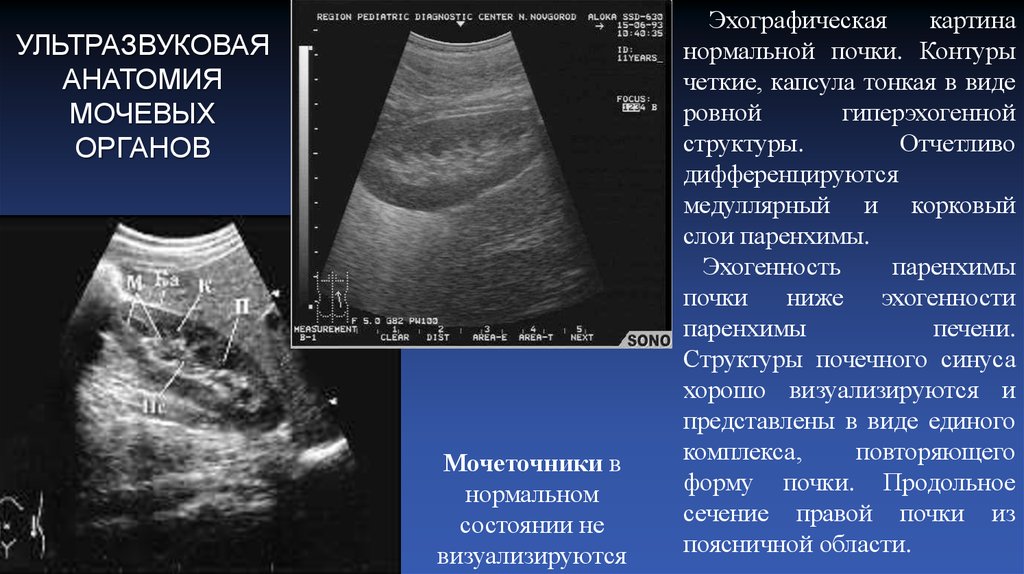 Эхографические признаки