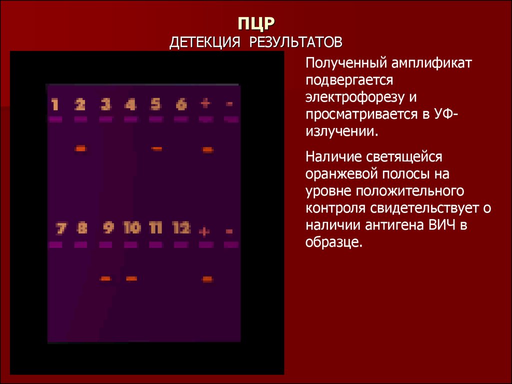 Детекция что это. Детекция результатов ПЦР. Методы детекции результата ПЦР. Электрофореграмма результатов ПЦР. Визуализация результатов ПЦР.