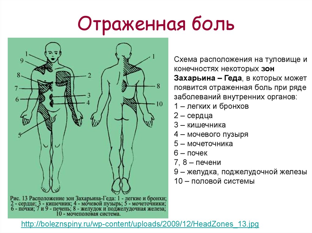 Больная зона. Схема расположения зон Захарьина Геда. Зоны Захарьина Геда на спине. Таблица Захарьева-Геда. Зоны Захарьина-Геда схема и описание атлас.