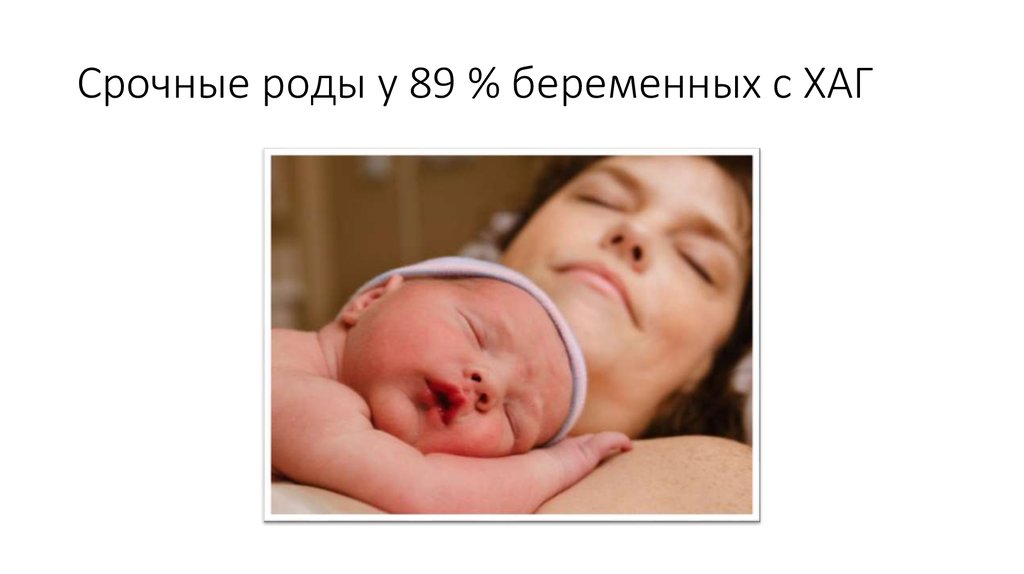 Срочные роды