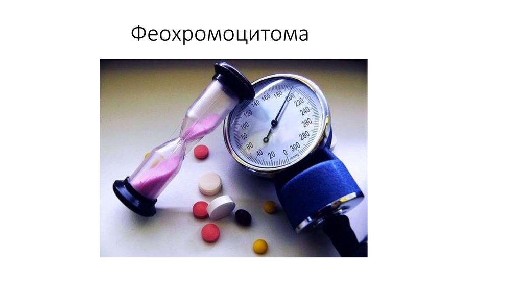 Феохромоцитома