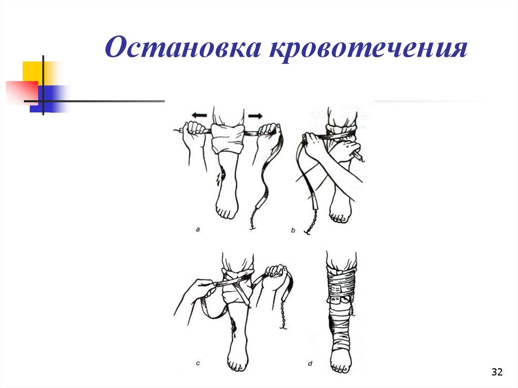 Остановка кровотечения общая хирургия презентация