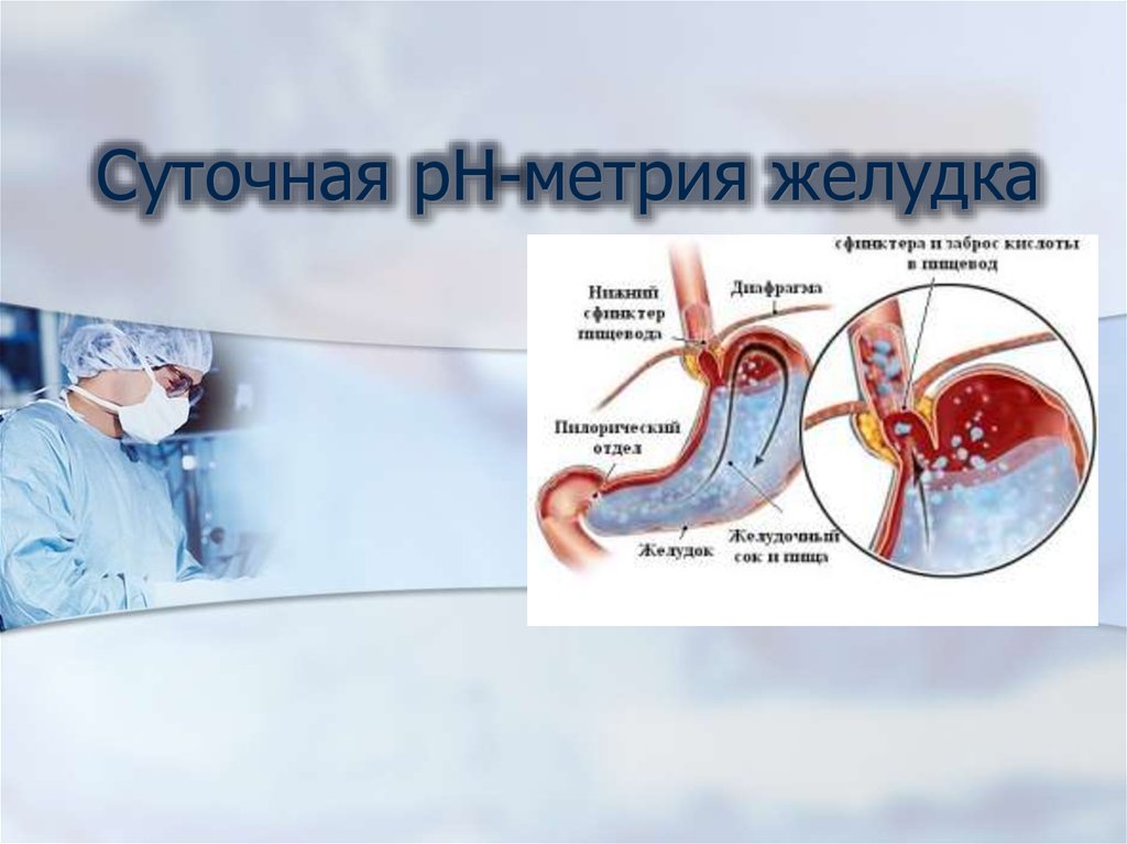 Ph метрия. Внутрижелудочковая РН метрия норма. PH метрия желудка. Суточная РН-метрия желудка. Суточное мониторирование PH-желудка.