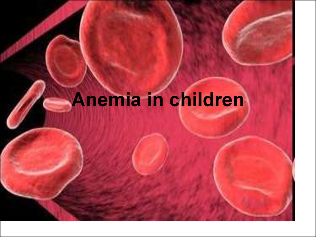 Anemia in children