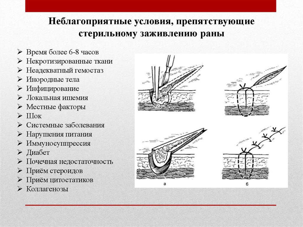 Через сколько заживает рана