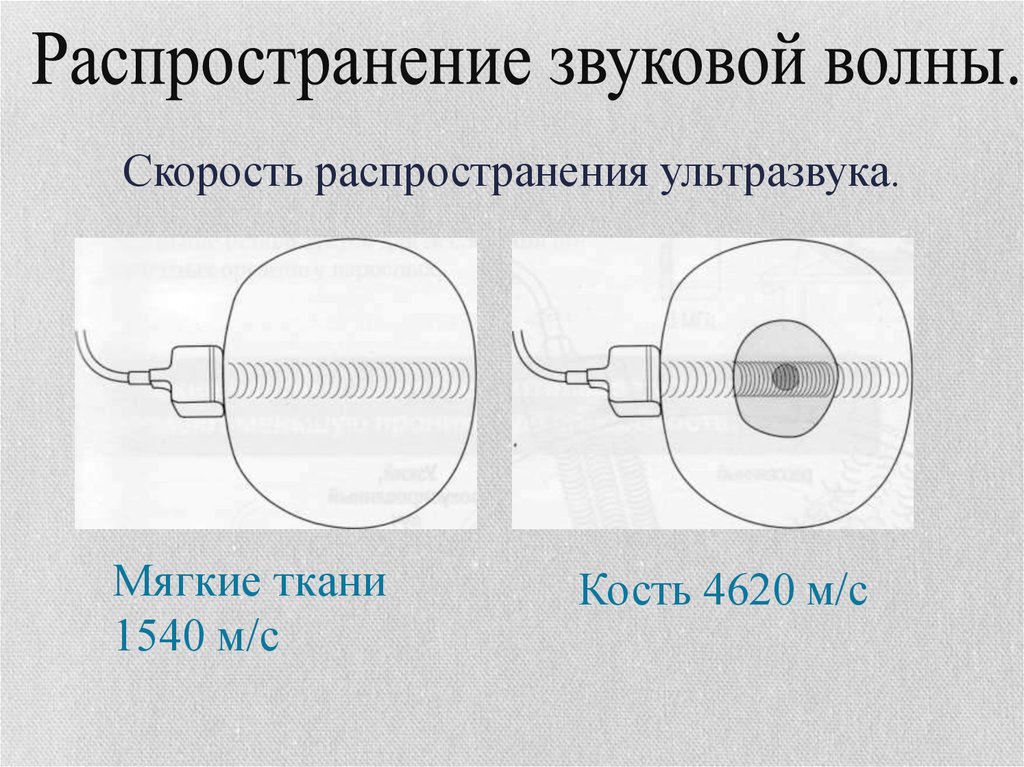 Основная тканевая характеристика ультразвукового изображения