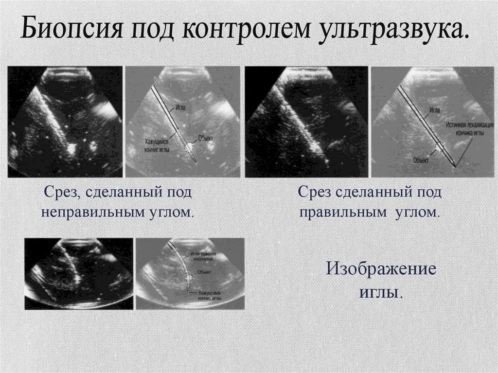 Ультразвук в медицине презентация