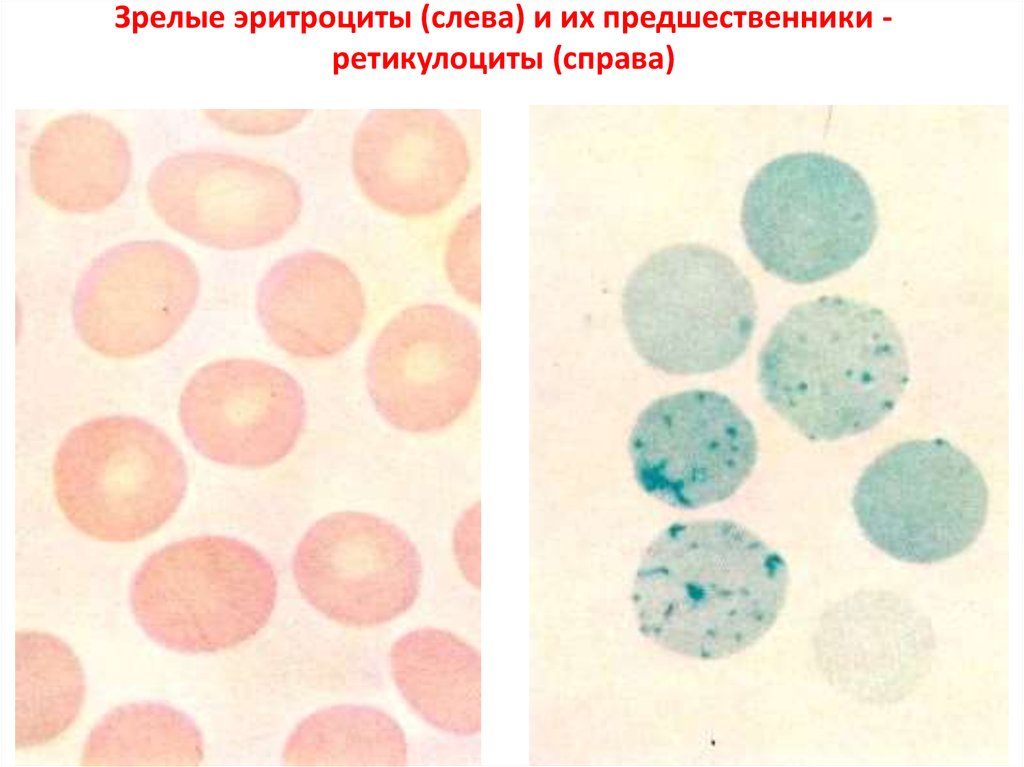 Ретикулоциты фото под микроскопом