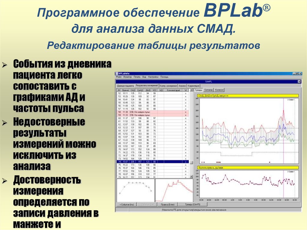 Мониторирование данных. Мониторинг артериального давления. BPLAB суточный монитор артериального давления. Суточный мониторинг артериального давления график. СМАД суточный мониторинг артериального давления.
