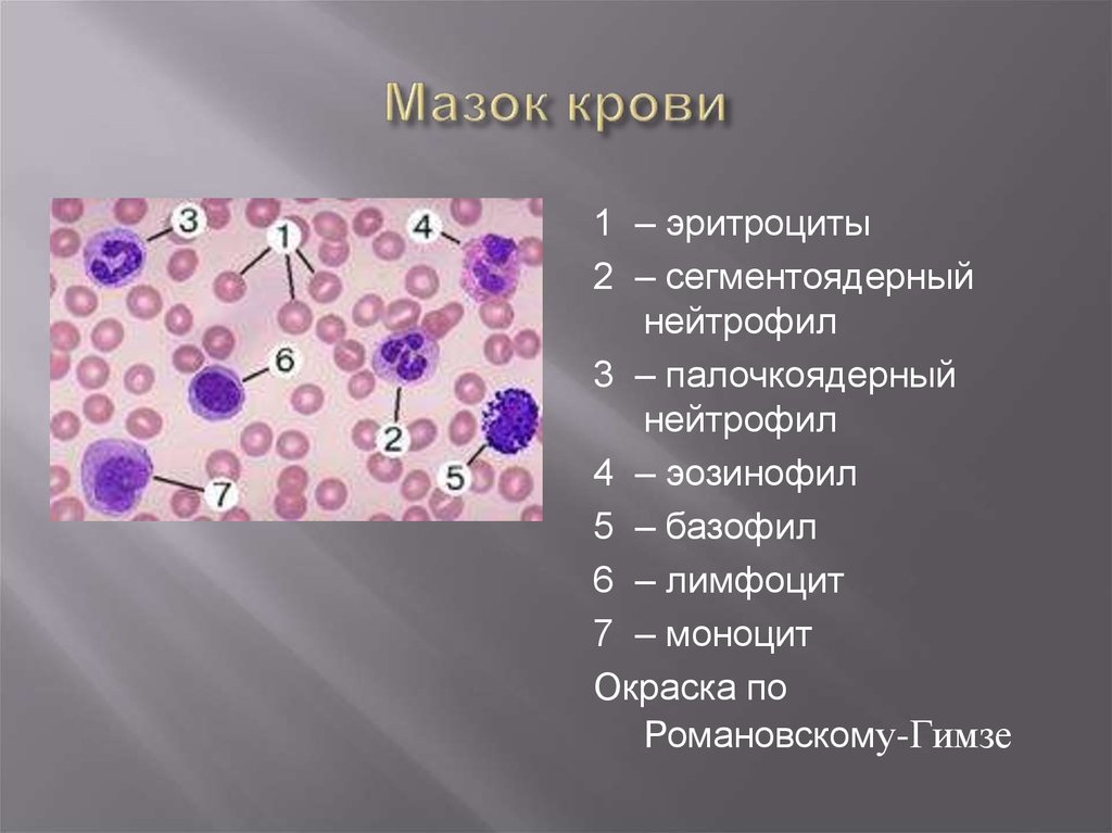 Кровь на б клетки. Клетки крови мазок гистология. Мазок крови : эритроцит, нейтрофил,эозинофил. Клетки крови микроскопия. Мазок периферической крови с микроскопией.