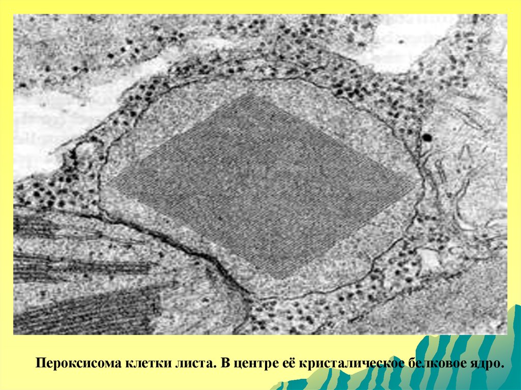 Электронная фотография листа. Электронограмма пероксисомы. Пероксисома гистология. Пероксисомы строение микроскоп. Пероксисома электронная микроскопия.