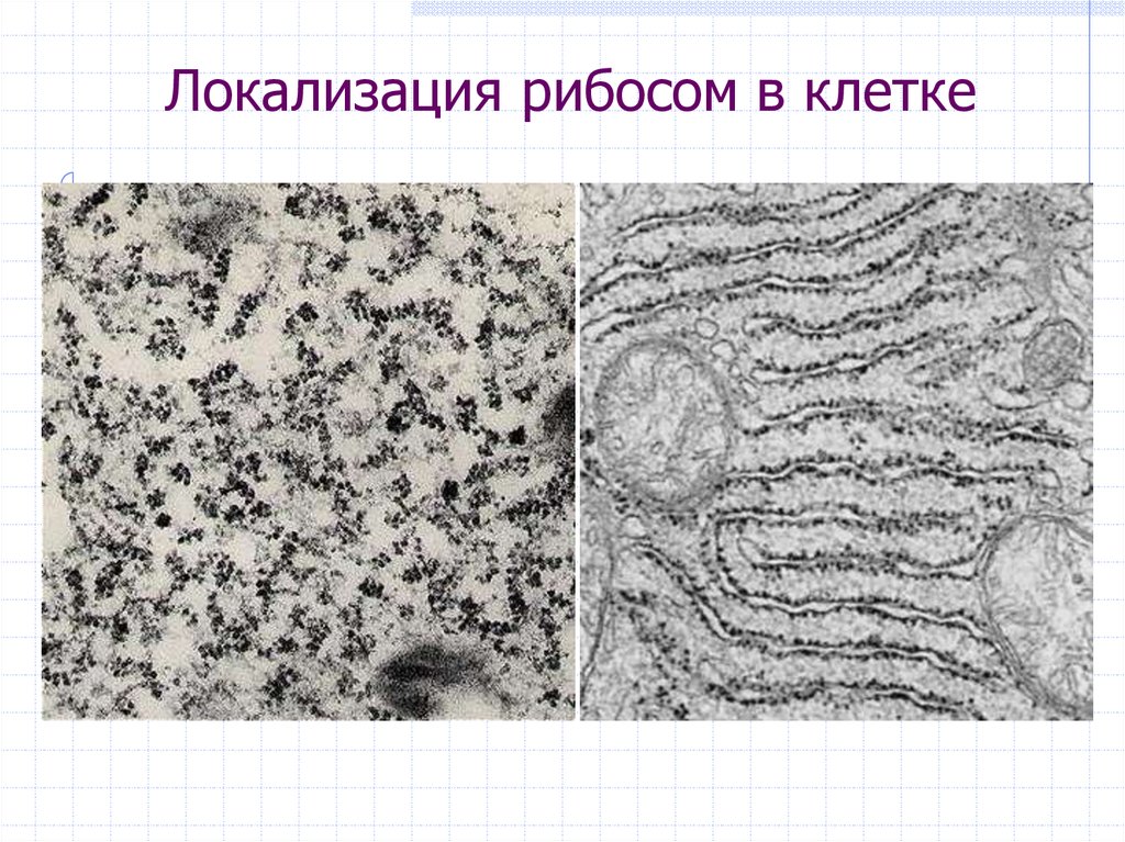 Рибосомы растительной клетки. Локализация рибосом. Рибосомы в клетке. Локализация в клетке. Рибосомы локализуются.