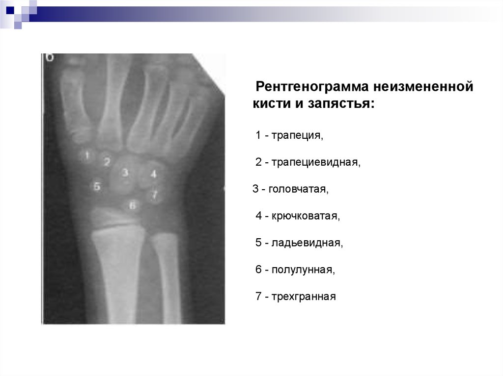 Схема описания рентгенограммы костей