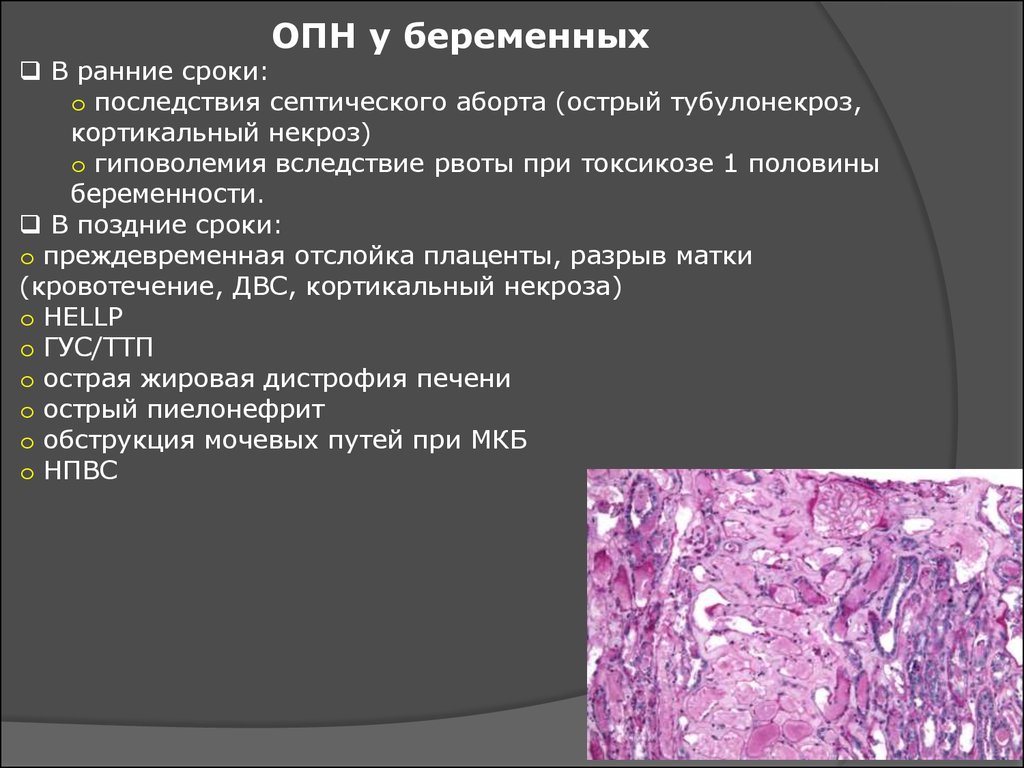 Сроки последствия. Острый тубулонекроз почки. Кортикальный некроз почек. Кортикальный некроз некроз почки. Кортикальный некроз почки на УЗИ.