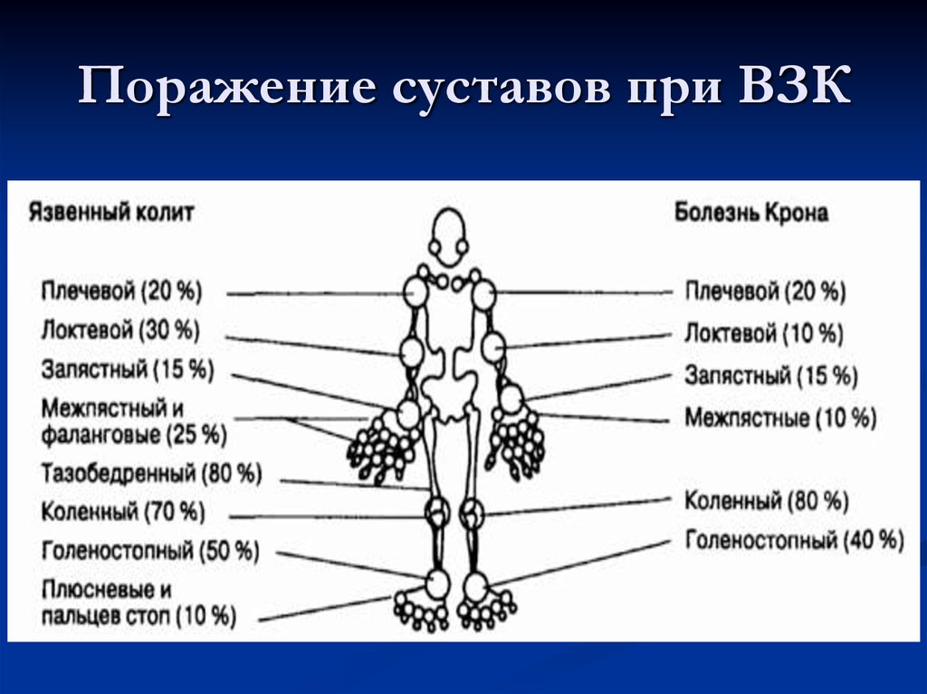 Поражение суставов